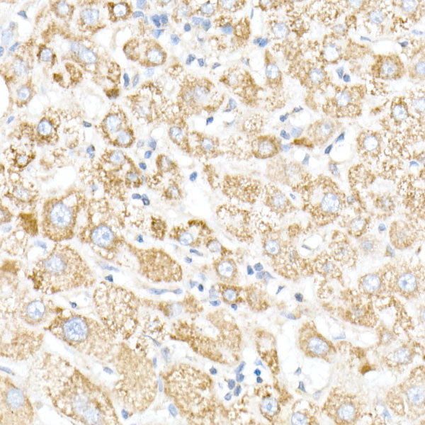 NDUFB4 Rabbit mAb