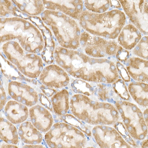 NDUFB4 Rabbit mAb