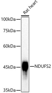 NDUFS2 Rabbit mAb