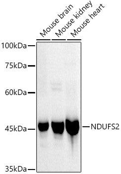 NDUFS2 Rabbit mAb