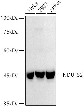 NDUFS2 Rabbit mAb