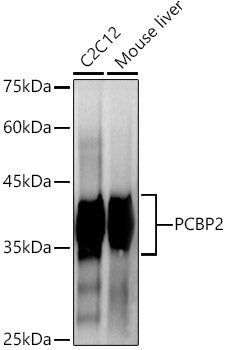 hnRNP E2/PCBP2 Rabbit mAb
