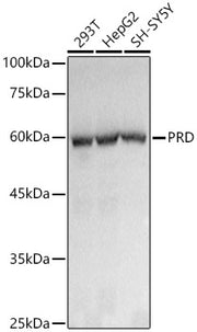 PRD Rabbit mAb