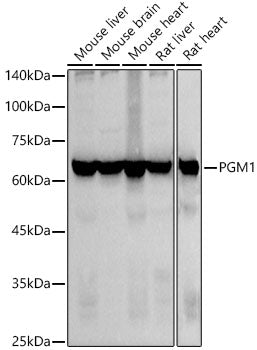PGM1 Rabbit mAb