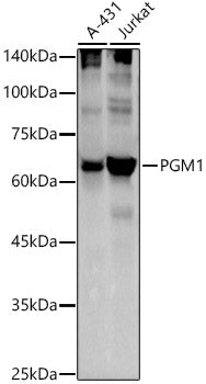 PGM1 Rabbit mAb