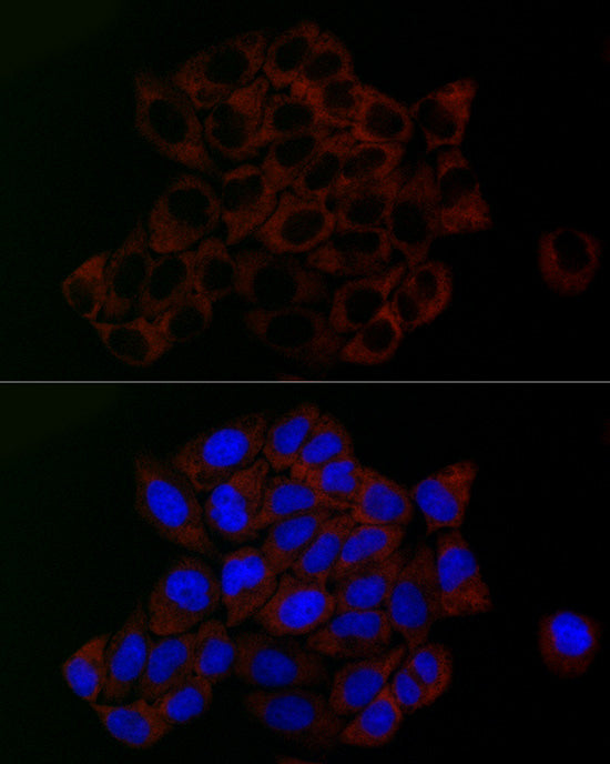 PGM1 Rabbit mAb