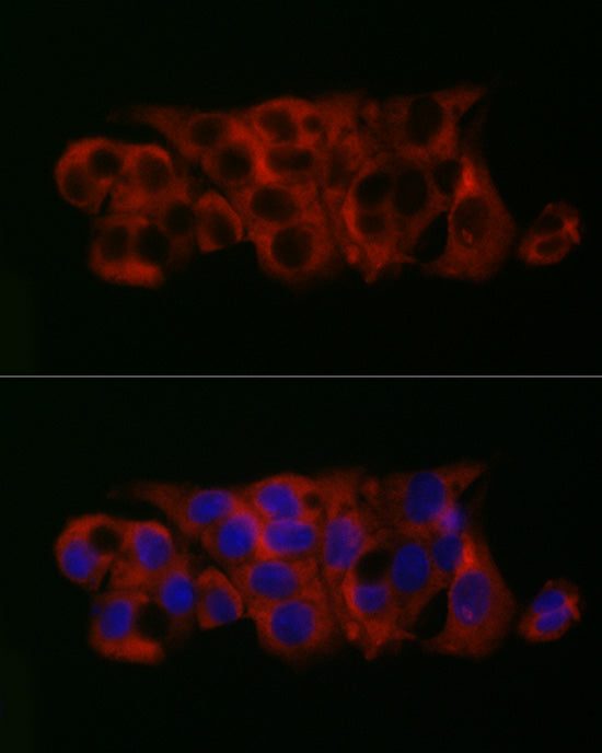 PGM1 Rabbit mAb