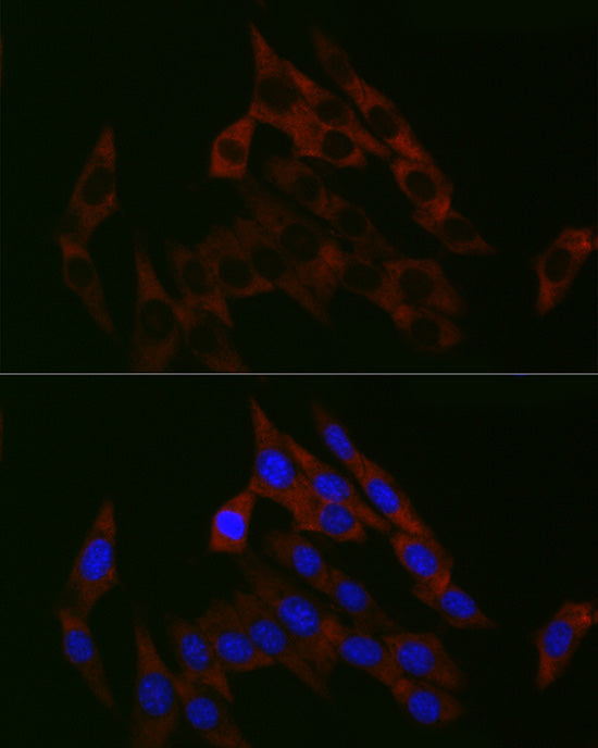 PGM1 Rabbit mAb