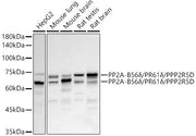 PP2A-B56δ/PR61δ/PPP2R5D Rabbit mAb