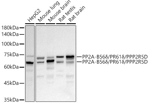 PP2A-B56δ/PR61δ/PPP2R5D Rabbit mAb