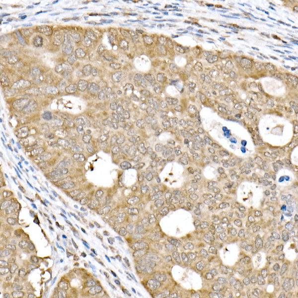 PP2A-B56δ/PR61δ/PPP2R5D Rabbit mAb