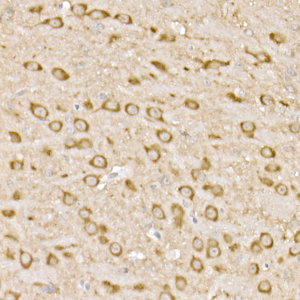 PP2A-B56δ/PR61δ/PPP2R5D Rabbit mAb