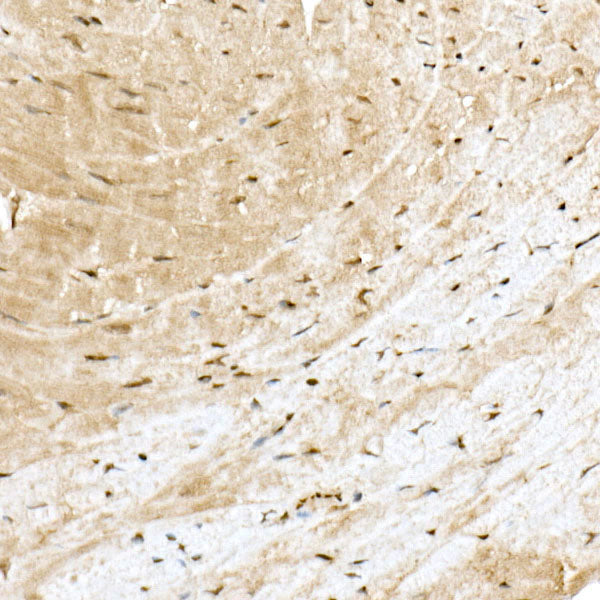 PP2A-B56δ/PR61δ/PPP2R5D Rabbit mAb
