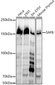 SAFB Rabbit mAb
