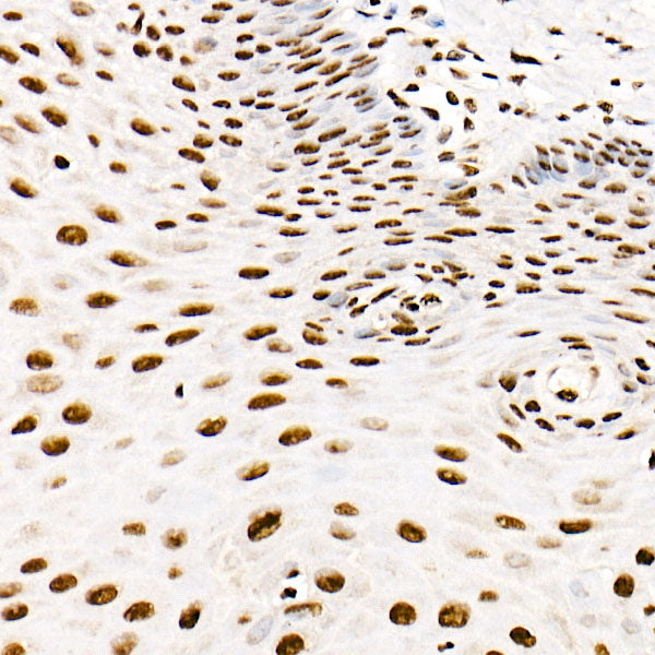 SAFB Rabbit mAb