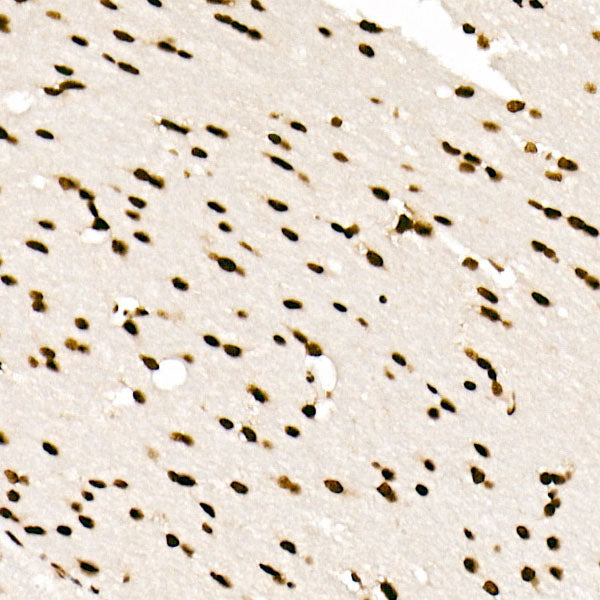 SAFB Rabbit mAb