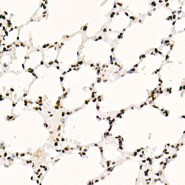 SAFB Rabbit mAb