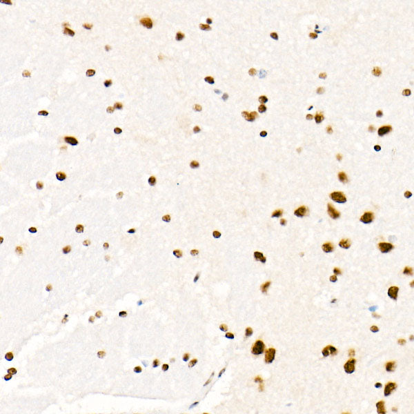 SAFB Rabbit mAb
