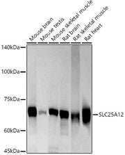 SLC25A12 Rabbit mAb