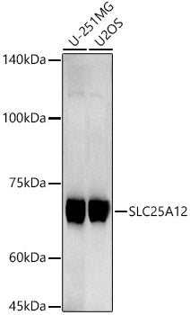 SLC25A12 Rabbit mAb