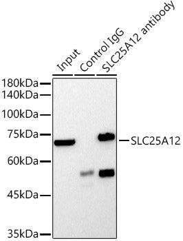 SLC25A12 Rabbit mAb