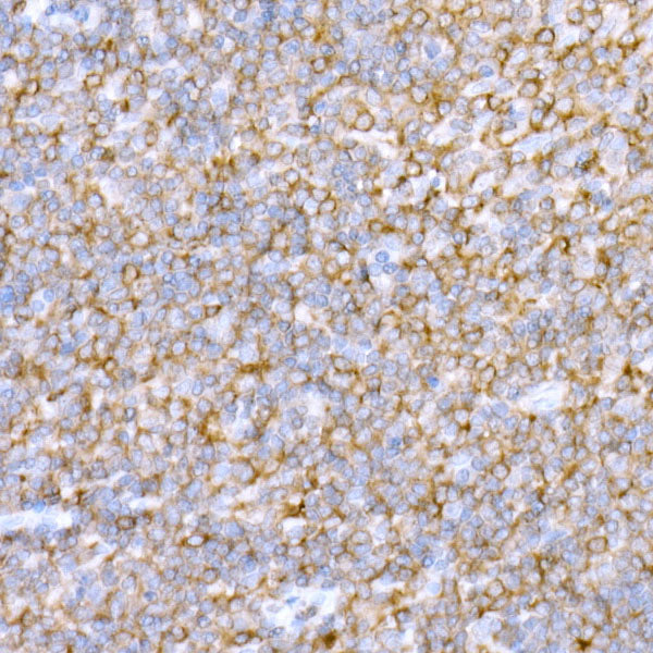 NMI Rabbit mAb