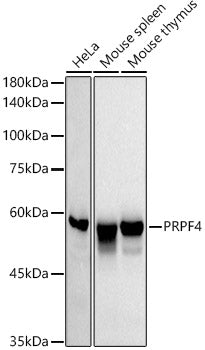 PRPF4 Rabbit mAb