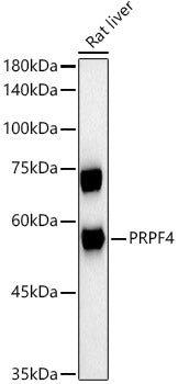 PRPF4 Rabbit mAb