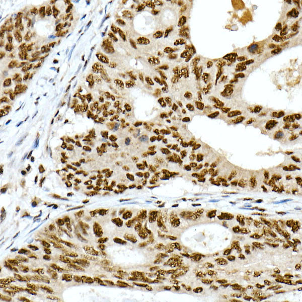 PRPF4 Rabbit mAb