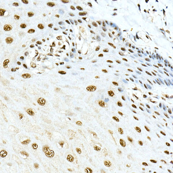 PRPF4 Rabbit mAb