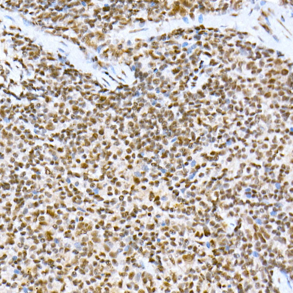 PRPF4 Rabbit mAb