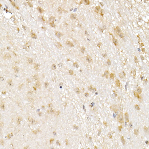 NOLC1 Rabbit mAb