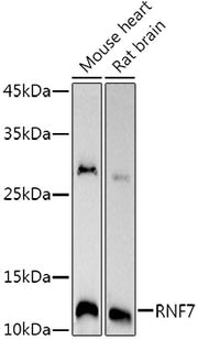 RNF7 Rabbit mAb
