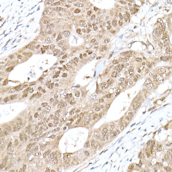 RNF7 Rabbit mAb