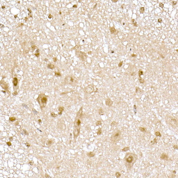 RNF7 Rabbit mAb