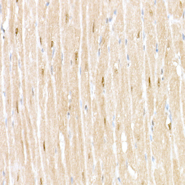 RNF7 Rabbit mAb