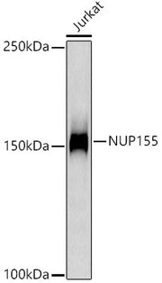 NUP155 Rabbit mAb