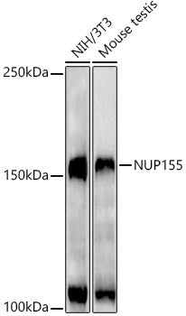 NUP155 Rabbit mAb