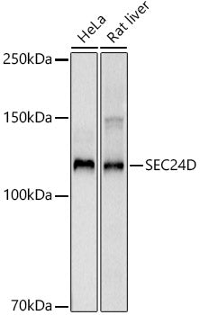 SEC24D Rabbit mAb