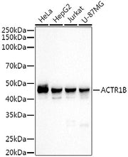 ACTR1B Rabbit mAb