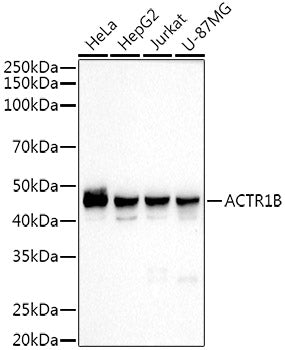ACTR1B Rabbit mAb