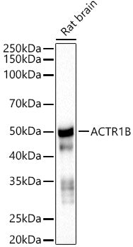 ACTR1B Rabbit mAb