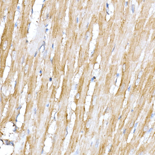 ACTR1B Rabbit mAb