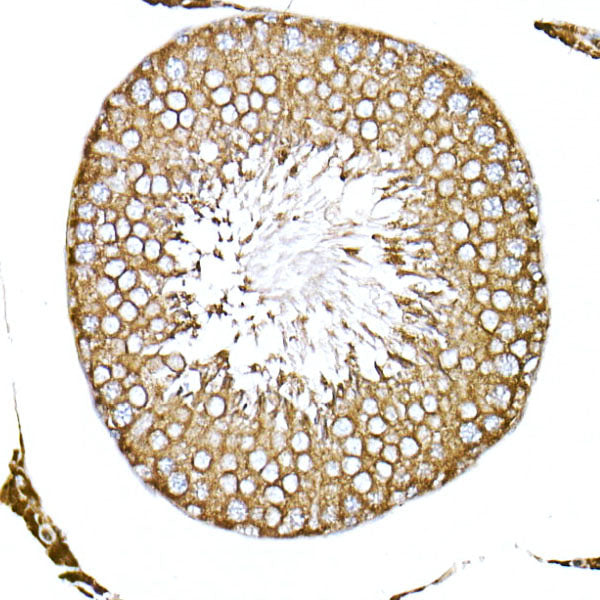 ACTR1B Rabbit mAb