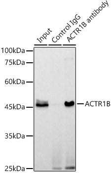 ACTR1B Rabbit mAb