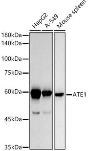 ATE1 Rabbit mAb