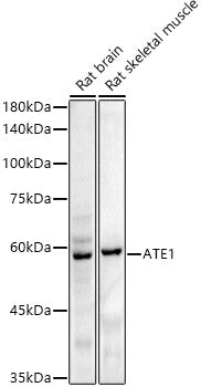 ATE1 Rabbit mAb