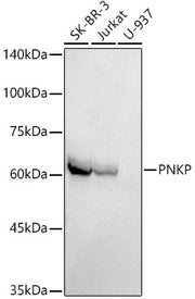 PNKP Rabbit mAb