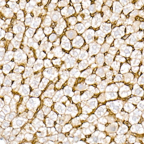 CD147 Rabbit mAb