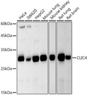 CLIC4 Rabbit mAb
